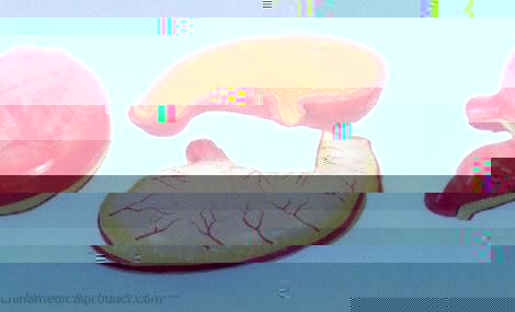 medical-product